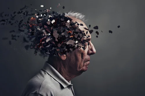 мужчина с болезнью Альцгеймера